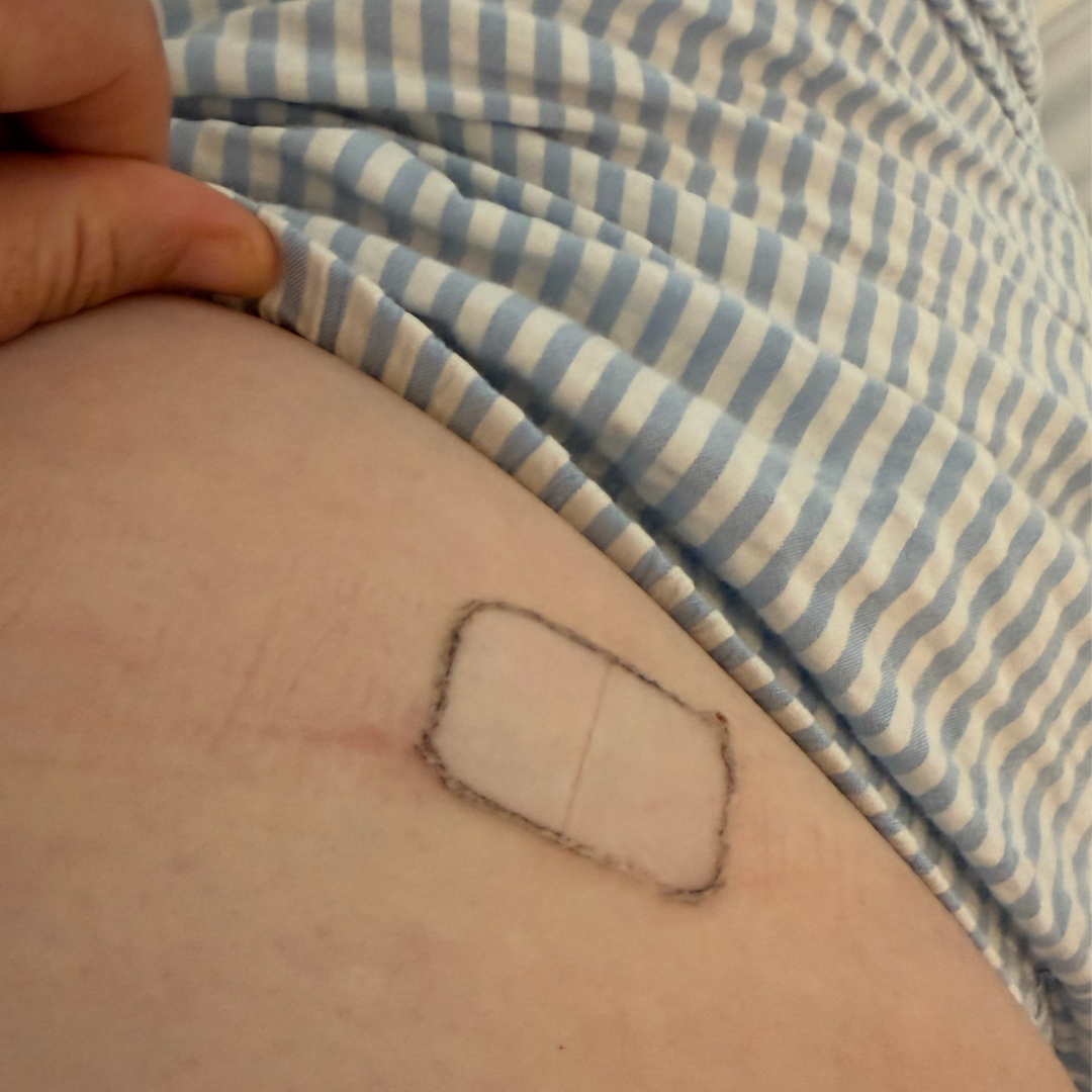 HRT Patch Removal AKA Toilet Drops
